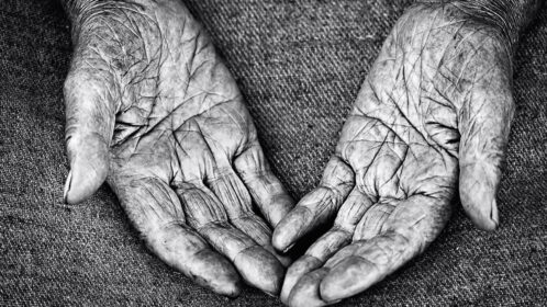 Aged care reforms: Changes to services, increased costs