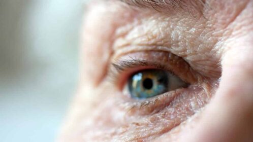 What is the Medicare Safety Net and am I eligible?
